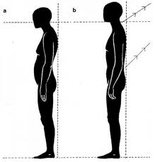 diagram of posture